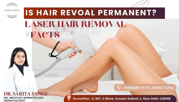Laser hair removal treatment video- Dermorita